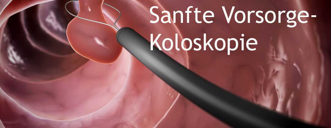 Sanfte Koloskopie